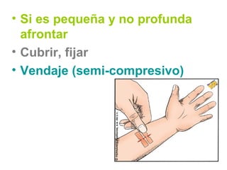 • Si es pequeña y no profunda
afrontar
• Cubrir, fijar
• Vendaje (semi-compresivo)
 