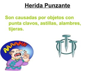 Herida Punzante
Son causadas por objetos con
punta clavos, astillas, alambres,
tijeras.
 
