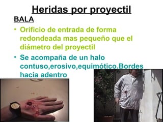 Heridas por proyectil
BALA
• Orificio de entrada de forma
redondeada mas pequeño que el
diámetro del proyectil
• Se acompaña de un halo
contuso,erosivo,equimótico.Bordes
hacia adentro
 