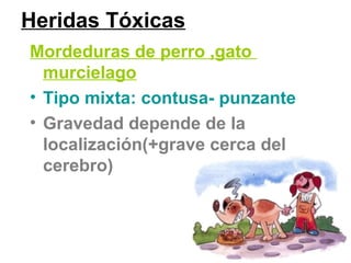 Heridas Tóxicas
Mordeduras de perro ,gato
murcielago
• Tipo mixta: contusa- punzante
• Gravedad depende de la
localización(+grave cerca del
cerebro)
 