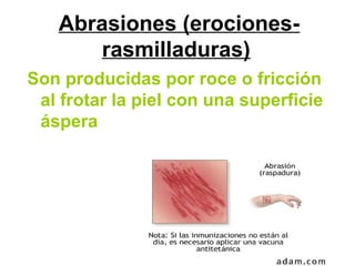 Abrasiones (erociones-
rasmilladuras)
Son producidas por roce o fricción
al frotar la piel con una superficie
áspera
 