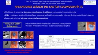Computer Aided Detection and Diagnosis in medical imaging: a review of ...