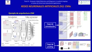 Computer Aided Detection and Diagnosis in medical imaging: a review of ...