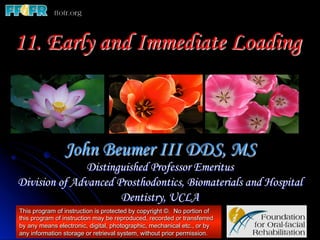 11. Early and Immediate Loading



                John Beumer III DDS, MS
               Distinguished Professor Emeritus
Division of Advanced Prosthodontics, Biomaterials and Hospital
                      Dentistry, UCLA
This program of instruction is protected by copyright ©. No portion of
this program of instruction may be reproduced, recorded or transferred
by any means electronic, digital, photographic, mechanical etc., or by
any information storage or retrieval system, without prior permission.
 