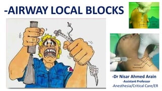 -AIRWAY LOCAL BLOCKS
-Dr Nisar Ahmed Arain
-Assistant Professor
-Anesthesia/Critical Care/ER
 