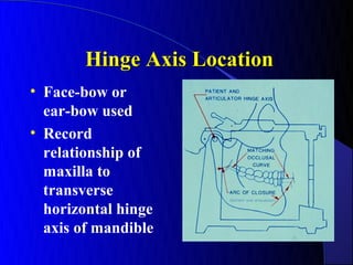 Hinge Axis Location
• Face-bow or
  ear-bow used
• Record
  relationship of
  maxilla to
  transverse
  horizontal hinge
  axis of mandible
 