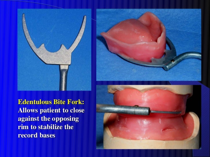 11. max mand rel facebow