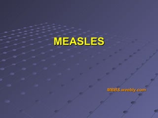 MEASLES MBBS.weebly.com 