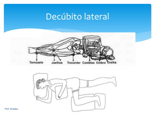 Decúbito lateral

Prof. Amadeu

107

 