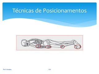 Técnicas de Posicionamentos

Prof. Amadeu

134

 