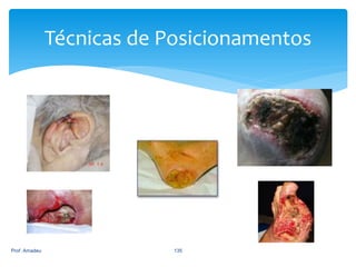 Técnicas de Posicionamentos

Prof. Amadeu

135

 