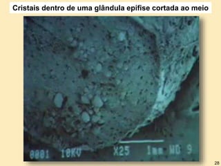 Cristais dentro de uma glândula epífise cortada ao meio
28
 