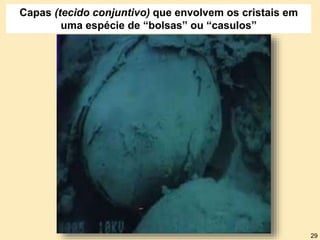 Capas (tecido conjuntivo) que envolvem os cristais em
uma espécie de “bolsas” ou “casulos”
29
 