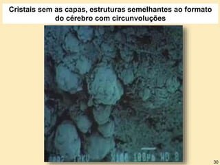 Cristais sem as capas, estruturas semelhantes ao formato
do cérebro com circunvoluções
30
 