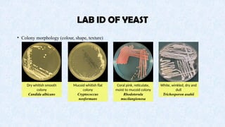 11 - Mycology Part 1.pptx 11 - Mycology Part 1.pptx