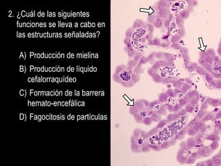 2. ¿Cuál de las siguientes
   funciones se lleva a cabo en
   las estructuras señaladas?

   A) Producción de mielina
   B) Producción de líquido
     cefalorraquídeo
   C) Formación de la barrera
     hemato-encefálica
   D) Fagocitosis de partículas
 