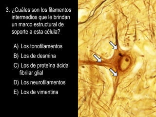 3. ¿Cuáles son los filamentos
   intermedios que le brindan
   un marco estructural de
   soporte a esta célula?

   A) Los tonofilamentos
   B) Los de desmina
   C) Los de proteína ácida
     fibrilar glial
   D) Los neurofilamentos
   E) Los de vimentina
 