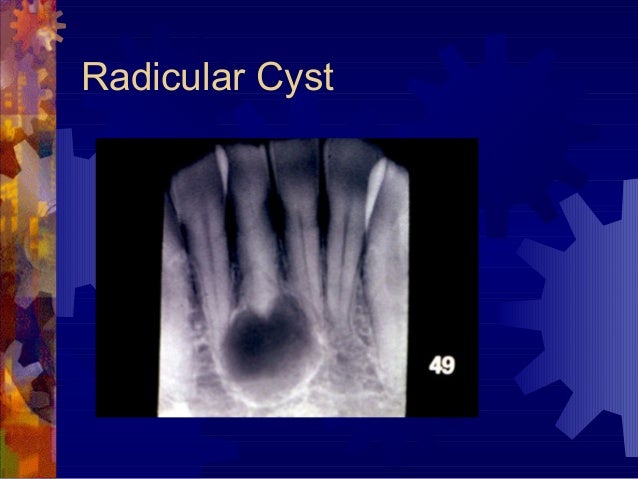 11 odontogenic-tumors-2002-02-slides-100510035212-phpapp02