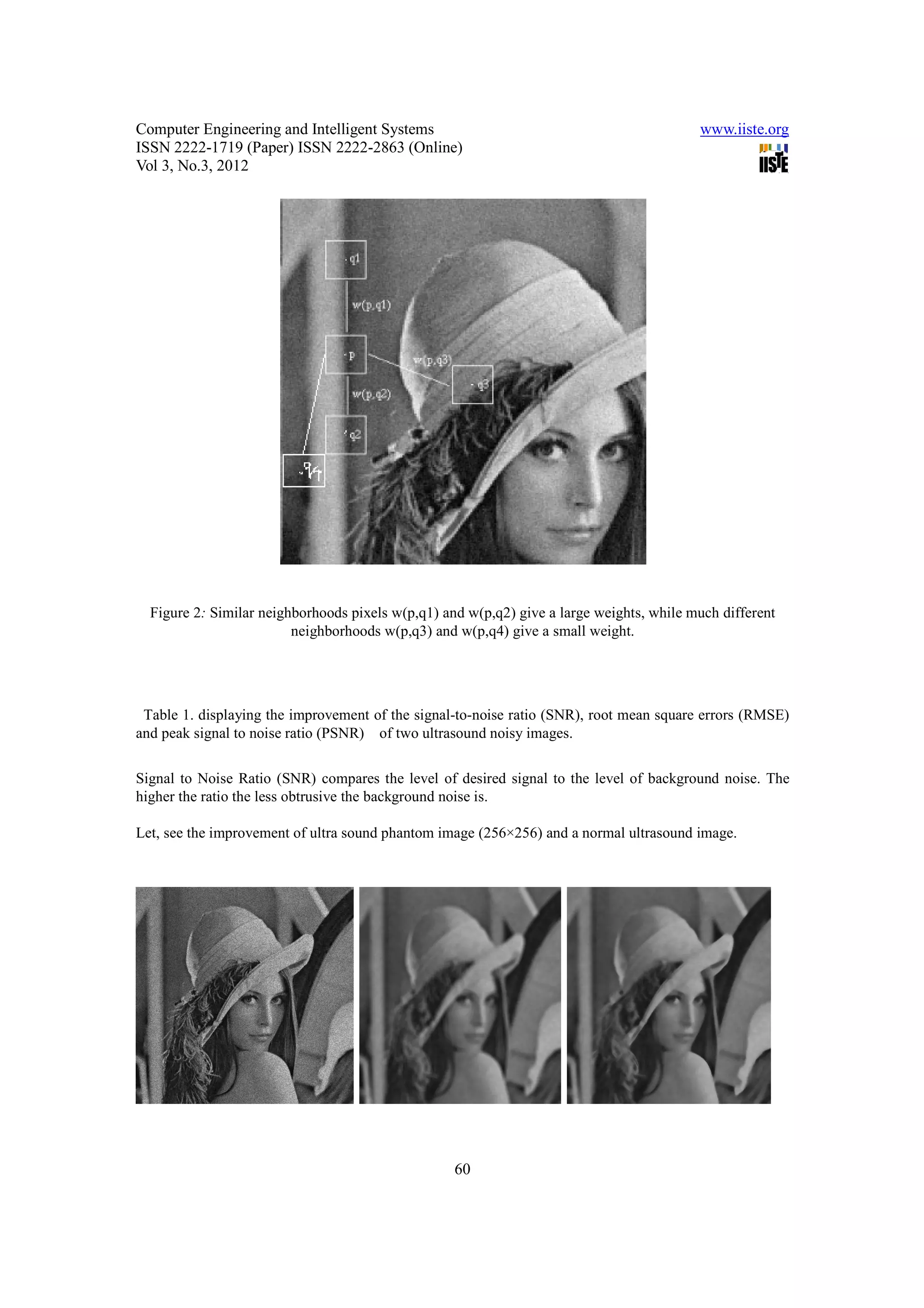 Computer Engineering and Intelligent Systems                                              www.iiste.org
ISSN 2222-1719 (Paper) ISSN 2222-2863 (Online)
Vol 3, No.3, 2012




  Figure 2: Similar neighborhoods pixels w(p,q1) and w(p,q2) give a large weights, while much different
                         neighborhoods w(p,q3) and w(p,q4) give a small weight.




 Table 1. displaying the improvement of the signal-to-noise ratio (SNR), root mean square errors (RMSE)
and peak signal to noise ratio (PSNR) of two ultrasound noisy images.


Signal to Noise Ratio (SNR) compares the level of desired signal to the level of background noise. The
higher the ratio the less obtrusive the background noise is.

Let, see the improvement of ultra sound phantom image (256×256) and a normal ultrasound image.




                                                   60
 