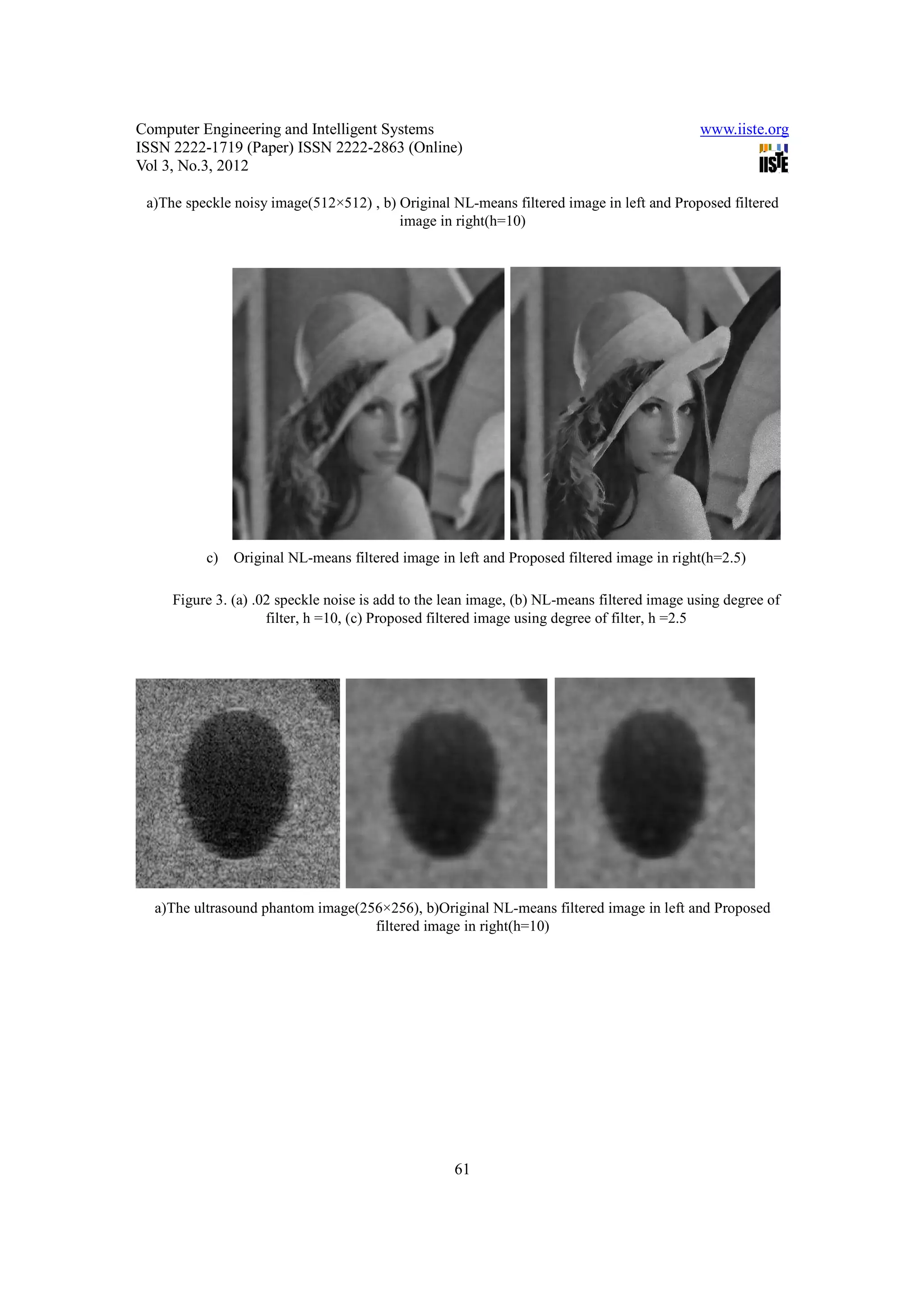 Computer Engineering and Intelligent Systems                                                www.iiste.org
ISSN 2222-1719 (Paper) ISSN 2222-2863 (Online)
Vol 3, No.3, 2012

 a)The speckle noisy image(512×512) , b) Original NL-means filtered image in left and Proposed filtered
                                         image in right(h=10)




          c)   Original NL-means filtered image in left and Proposed filtered image in right(h=2.5)

     Figure 3. (a) .02 speckle noise is add to the lean image, (b) NL-means filtered image using degree of
                     filter, h =10, (c) Proposed filtered image using degree of filter, h =2.5




  a)The ultrasound phantom image(256×256), b)Original NL-means filtered image in left and Proposed
                                   filtered image in right(h=10)




                                                   61
 