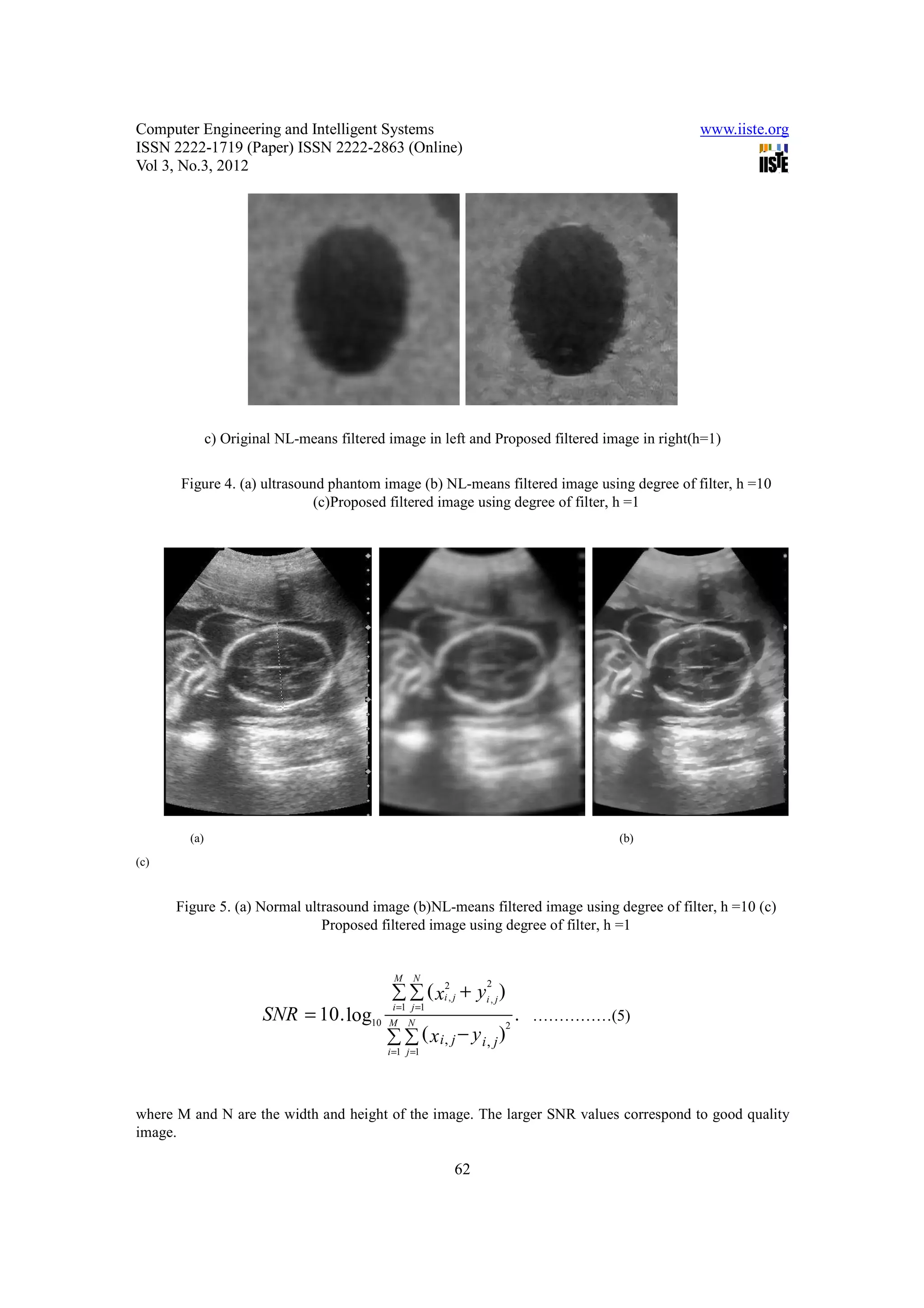 Computer Engineering and Intelligent Systems                                                                     www.iiste.org
ISSN 2222-1719 (Paper) ISSN 2222-2863 (Online)
Vol 3, No.3, 2012




              c) Original NL-means filtered image in left and Proposed filtered image in right(h=1)

      Figure 4. (a) ultrasound phantom image (b) NL-means filtered image using degree of filter, h =10
                             (c)Proposed filtered image using degree of filter, h =1




        (a)                                                                                    (b)
(c)


      Figure 5. (a) Normal ultrasound image (b)NL-means filtered image using degree of filter, h =10 (c)
                              Proposed filtered image using degree of filter, h =1


                                             M     N
                                             ∑ ∑ ( xi2, j + yi , j )
                                                                2

                                             i =1 j =1
                       SNR = 10 . log10     M    N
                                                                           .......... .......... ........(16 )
                                                                               ……………(5)
                                            ∑ ∑ ( xi, j − y i, j )
                                                                       2

                                            i =1 j =1




where M and N are the width and height of the image. The larger SNR values correspond to good quality
image.

                                                         62
 