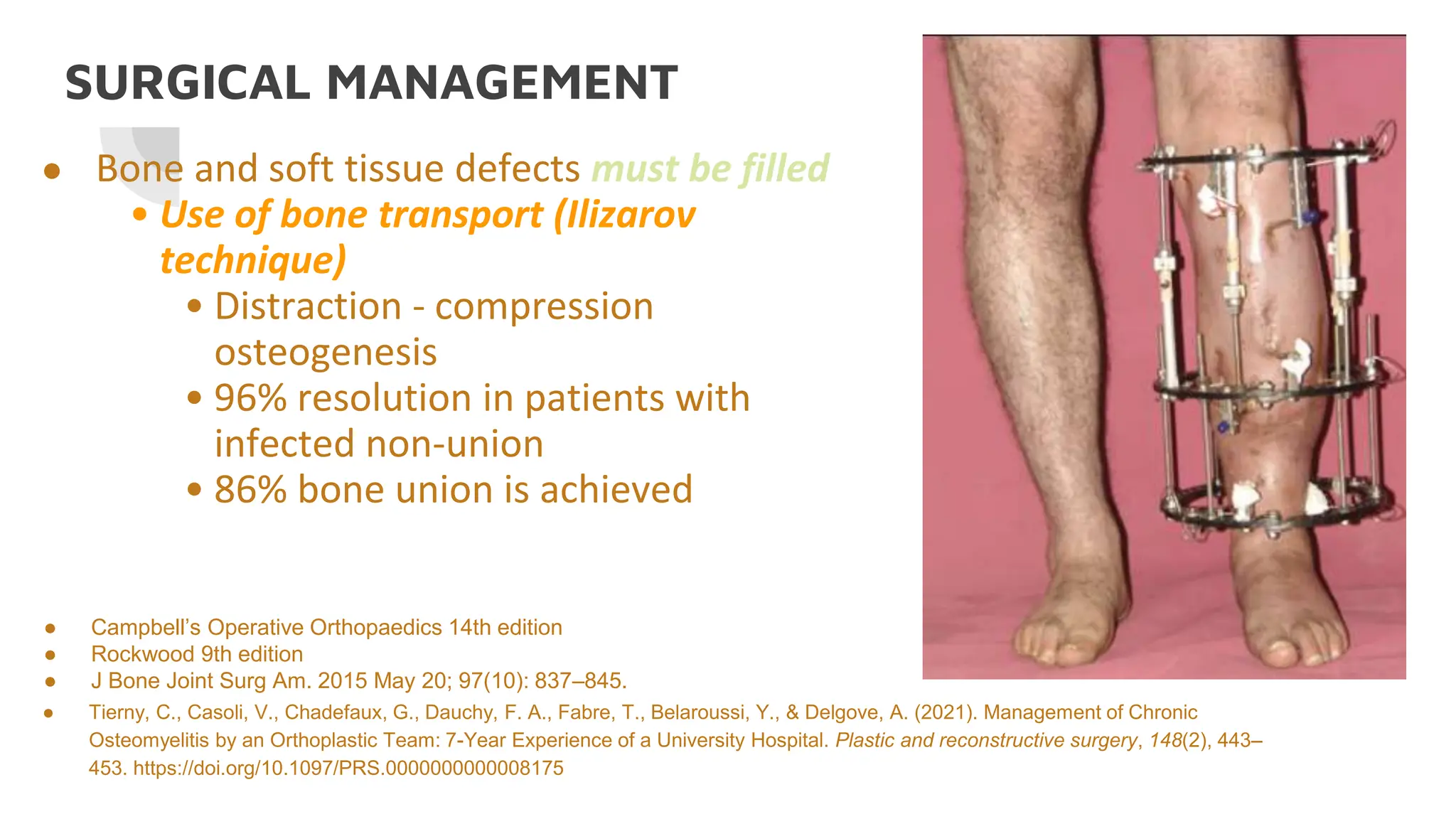 Bone Transfer 11 - Osteomyelitis - Imperial 2.pptx…….. | PPTX