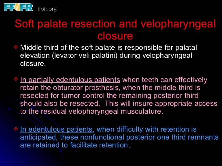 11. palatal resections alterations at surgery to enhance the prosthet…