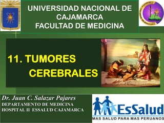 UNIVERSIDAD NACIONAL DE
CAJAMARCA
FACULTAD DE MEDICINA
Dr. Juan C. Salazar Pajares
DEPARTAMENTO DE MEDICINA
HOSPITAL II ESSALUD CAJAMARCA
11. TUMORES
CEREBRALES
 