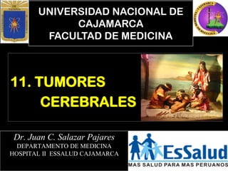 UNIVERSIDAD NACIONAL DE
CAJAMARCA
FACULTAD DE MEDICINA
Dr. Juan C. Salazar Pajares
DEPARTAMENTO DE MEDICINA
HOSPITAL II ESSALUD CAJAMARCA
11. TUMORES
CEREBRALES
 