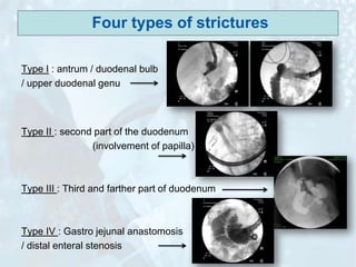 Gooss Endoscopy in Gastrointestinal Oncology - Slide 11 - G. Vanbiervliet ...