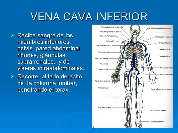 11. Vena Cava Inferior