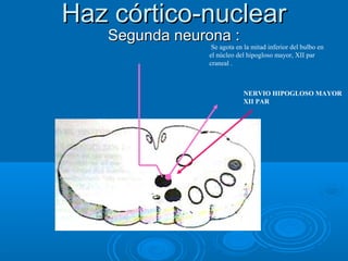 Haz córtico-nuclearHaz córtico-nuclear
Segunda neurona :Segunda neurona :
Se agota en la mitad inferior del bulbo en
el núcleo del hipogloso mayor, XII par
craneal .
NERVIO HIPOGLOSO MAYOR
XII PAR
 