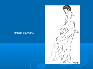 Marcha estepada
 