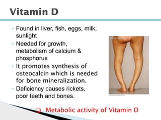 ? Found in liver, fish, eggs, milk,
sunlight
? Needed for growth,
metabolism of calcium &
phosphorus
? It promotes synthesis of
osteocalcin which is needed
for bone mineralization.
? Deficiency causes rickets,
poor teeth and bones.
Vitamin D
❑ Metabolic activity of Vitamin D
 