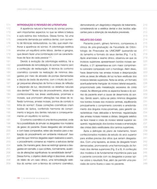 Contorno cosmético - estética sem restauração

171

Introdução e revisão de literatura

demonstrando um diagnóstico integrado de tratamento,

210

considerando-se a estética dental e dos tecidos adja-

211

centes para a obtenção de resultados previsíveis.

212

172

A aparência natural e harmonia do sorriso promo-

173

vem importantes aspectos no que se refere à beleza

174

e auto-estima dos indivíduos. Dessa forma, há uma

175

crescente demanda por estética dental, com aumen-

176

to de técnicas restauradoras, ou não, que visam me-

Paciente jovem, gênero feminino, compareceu à

215

177

lhorar a aparência do sorriso. A odontologia estética

clinica de pós-graduação da Faculdade de Odon-

216

178

envolve um equilíbrio entre lábios, dentes e gengiva,

tologia de Piracicaba da UNICAMP queixando-se

217

179

que devem fazer uma combinação com as caracterís-

do tamanho e formato do seus dentes (Fig. 1 a 5).

218

180

ticas de face de cada pessoa

Após anamnese e exame clínico, observou-se que os

219

1,2,3

.

213
Relato do caso

214

181

Devido à evolução da odontologia estética, há a

incisivos superiores apresentavam bordos incisais ser-

220

182

possibilidade de remodelação do sorriso mesmo sem

rilhados, o 21 apresentava-se com maior comprimen-

221

183

a confecção de restauração. A técnica do contorno

to coronário comparado com o homólogo. Além disso,

222

184

cosmético consiste na realização de mínimos des-

havia desarmonia nas ameias incisais e desproporção

223

185

gastes por meio de abrasão de pontas diamantadas

entre as áreas de reflexão de luz na face vestibular dos

224

186

e discos de óxido de alumínio, com o intuito de corri-

incisivos lateriais superiores. Nota-se ainda, um formato

225

187

gir pequenas alterações de forma e áreas de reflexão

acentuadamente triangular do incisivo laterial esquerdo,

226

188

e dispersão de luz, devolvendo os detalhes naturais

proporcionado pela mesialização excessiva da crista

227

189

dos dentes . Neste tipo de procedimento, slices são

mesial. As diferenças entre os aspectos faciais e do sor-

228

190

confeccionados nas áreas vestibulares, proximais e

riso da paciente eram a causa de desarmonia do sor-

229

191

incisais, que promovem alterações nas áreas de re-

riso. Sendo assim, optou-se pelos mínimos desgastes

230

192

flexão luminosa, ameias incisais, pontos de contato e

nos bordos incisais dos incisivos centrais, equilibrando

231

193

linha do sorriso . Essas correções cosméticas criam

principalmente o comprimento coronário e arredonda-

232

194

ilusões de óptica, conferindo harmonia de compri-

mento dos ângulos inciso-proximais, para garantir ca-

233

195

mento e largura dos dentes naturais e consequente-

racterísticas mais delicadas e femininas; regularização

234

196

mente um equilíbrio no sorriso.

das ameias incisais mesiais e distais; desgaste seletivo

235

4,5

5

197

O contorno cosmético é uma técnica previsível, onde

da face mesial e crista do incisivo laterial superior es-

236

198

há a possibilidade de simular os desgastes nos modelos

querdo; regularização dos bordos incisais e amenização

237

199

de gesso do paciente. Esses desgastes são simulados

das cristas disto-vestibulares dos caninos superiores.

238

200

e com base comparativa, estes são levados para a rea-

Após a definição do plano de tratamento, foram

239

201

lização do procedimento em ambiente intrabucal5. Isso

confeccionados modelos de estudo do arco superior

240

202

permite que mínimos degastes sejam realizados e assim,

para análise precisa dos sítios que seriam desgasta-

241

203

o procedimento conserve ao máximo a estrutura dental

dos. Com uma lapiseira, as áreas de desgaste foram

242

204

sadia. De maneira geral, deve-se restringir apenas a des-

demarcadas, promovendo uma harmonização do for-

243

205

gastes em esmalte, o que confere, normalmente, ausên-

mato dos dentes superiores (Fig. 6 a 9). A confecção

244

206

cia de alterações significativas na sensibilidade dental .

dos modelos é de fundamental importância para que

245

207

Dessa forma, o objetivo deste artigo é descrever, através

o paciente concorde com os desgastes e possa opi-

246

208

do relato de um caso clínico, uma remodelação esté-

nar sobre o resultado final, além de permitir uma pre-

247

209

tica do sorriso com a técnica do contorno cosmético,

cisão de como ficaria o caso no paciente.

248

6,7

120

Rev Dental Press Estét. 2012 out-dez;9(4):118-25

 