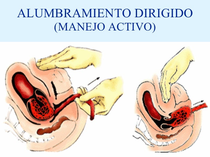 Image result for alumbramiento