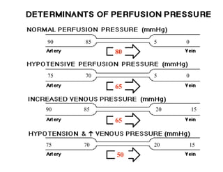 90   85        5    0
          80


75   70        5    0

          65


90   85        20       15

          65


75   70        20    15
          50        17
 