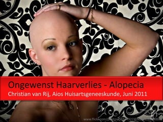 Ongewenst Haarverlies - Alopecia
Christian van Rij, Aios Huisartsgeneeskunde, Juni 2011


                             www.flickr.com/photos/59344927@N00/3083048861
 