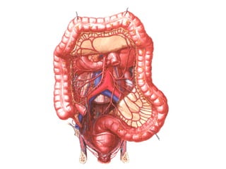 cancer de colon