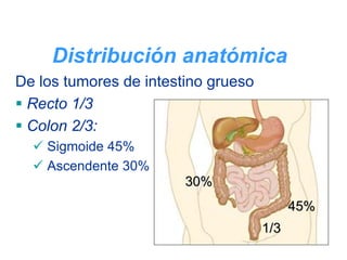 Distribución anatómica
De los tumores de intestino grueso
 Recto 1/3
 Colon 2/3:
    Sigmoide 45%
    Ascendente 30%
                        30%
                                           45%
                                     1/3
 