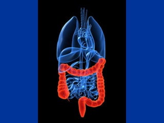 cancer de colon