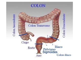 Ilíaco
Pelviano
Sigmoides
         Colon ilíaco
 