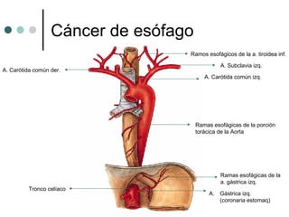 Cáncer de esófago
                                  Ramos esofágicos de la a. tiroidea inf.

                                               A. Subclavia izq.
A. Carótida común der.
                                         A. Carótida común izq.




                                      Ramas esofágicas de la porción
                                      torácica de la Aorta




                                               Ramas esofágicas de la
                                               a. gástrica izq.
         Tronco celíaco
                                           A. Gástrica izq.
                                              (coronaria estomaq)
 
