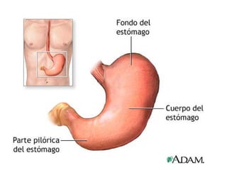 Cancer de estómago