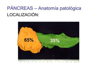 PÁNCREAS – Anatomía patológica
LOCALIZACIÓN:




      65%        35%
 