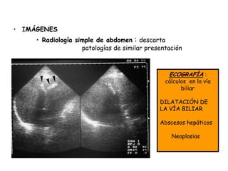 • IMÁGENES
     • Radiología simple de abdomen : descarta
                    patologías de similar presentación



                                                 ECOGRAFÍA :
                                                cálculos en la vía
                                                      biliar

                                              DILATACIÓN DE
                                              LA VÍA BILIAR

                                              Abscesos hepáticos

                                                  Neoplasias
 