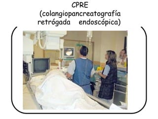 CPRE
 (colangiopancreatografía
retrógada endoscópica)
 