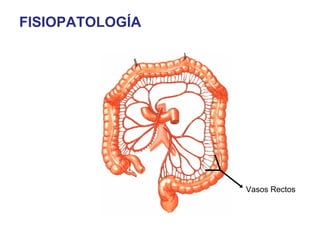 FISIOPATOLOGÍA




                 Vasos Rectos
 