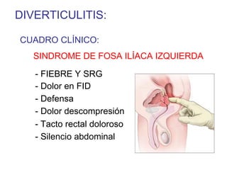 DIVERTICULITIS:

CUADRO CLÍNICO:
   SINDROME DE FOSA ILÍACA IZQUIERDA

   - FIEBRE Y SRG
   - Dolor en FID
   - Defensa
   - Dolor descompresión
   - Tacto rectal doloroso
   - Silencio abdominal
 