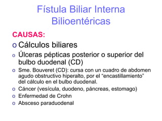 Fístula Biliar Interna
             Bilioentéricas
CAUSAS:
o Cálculos biliares
o   Úlceras pépticas posterior o superior del
    bulbo duodenal (CD)
o Sme. Bouveret (CD): cursa con un cuadro de abdomen
  agudo obstructivo hiperalto, por el “encastillamiento”
  del cálculo en el bulbo duodenal.
o Cáncer (vesícula, duodeno, páncreas, estomago)
o Enfermedad de Crohn
o Absceso paraduodenal
 